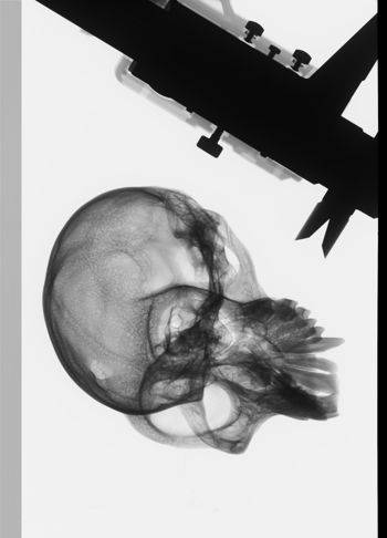 Media type: image;   Mammalogy 35600